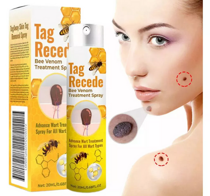 Tag Recede™: Spray Eliminador de Verrugas Instantáneo